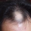 错错错！！！治脱发竟然还用这办法