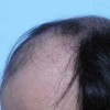 防止脱发措施