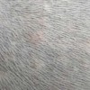 脓头癣的发生原因是什么