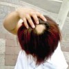 看斑秃去哪家医院好
