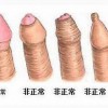 包皮过长原因有什么