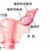 护理外阴白斑哪些方面需要注意