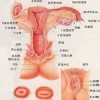 外阴白斑患处皮肤的护理事项有什么