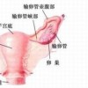日常护理对于外阴白斑的康复有作用吗