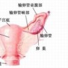 女性外阴白斑产生的原因