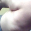 颅内脂肪瘤患者需要了解的信息