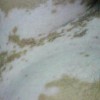 散发型白癜风的具体症状是怎样的