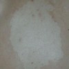 白癜风患者日常中如何保养