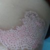 白癜风患者调节身心小妙招