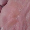 青岛脚气怎么治疗最有效