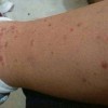 性病症状有什么呢