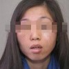 怎样去预防雀斑