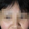预防雀斑的办法有什么