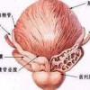 淋病的症状表现都有什么呢