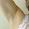 青少年腋臭如何根除