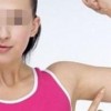 狐臭的治疗的手法优劣比较
