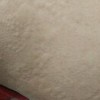 治疗荨麻疹专家诉说其3大危害