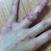 改善皮肤瘙痒有哪些预防措施