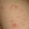 导致皮肤瘙痒的病因有什么