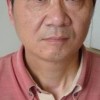 酒渣鼻的治疗办法有什么
