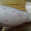 玫瑰糠疹的主要症状是什么