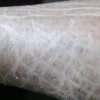 鱼鳞病症状了解