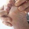 治疗手足癣的特效措施