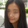 黄褐斑的治疗办法有什么