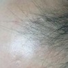 男性怎么正确预防脱发