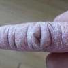 硬皮病该怎样预防呢