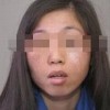 如何防止雀斑