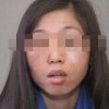 女性怎样的预防雀斑