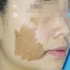 咖啡斑的价格受什么原因影响
