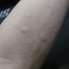 得了皮肤瘙痒吃什么好的快
