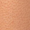 小儿皮肤瘙痒症病因是什么