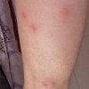 预防瘙痒可补充锰元素多喝茶