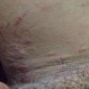 肛门瘙痒是怎么得的