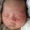 女性肛门瘙痒怎么办