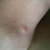 怎样对待艾滋病患者