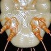 预防淋病的工作有哪些