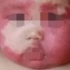 太田痣能不能越来越密