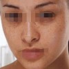 女性预防色斑的有效行为