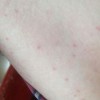 性病与平凡的传染病有什么不一样