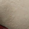 女性荨麻疹该咋办进行诊断
