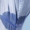 青岛狐臭哪家医院最佳