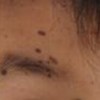 色素痣显示原因