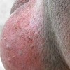 患有股癣通常是啥样子的