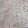 白癣与黄癣黑癣有什么不一样