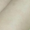 激光脱毛价格贵不贵
