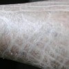 如何挣脱鱼鳞病